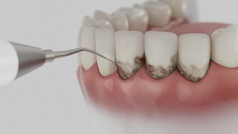 Trusted Root Canal Treatment service in Whitesboro, NJ - Dentist Open Now